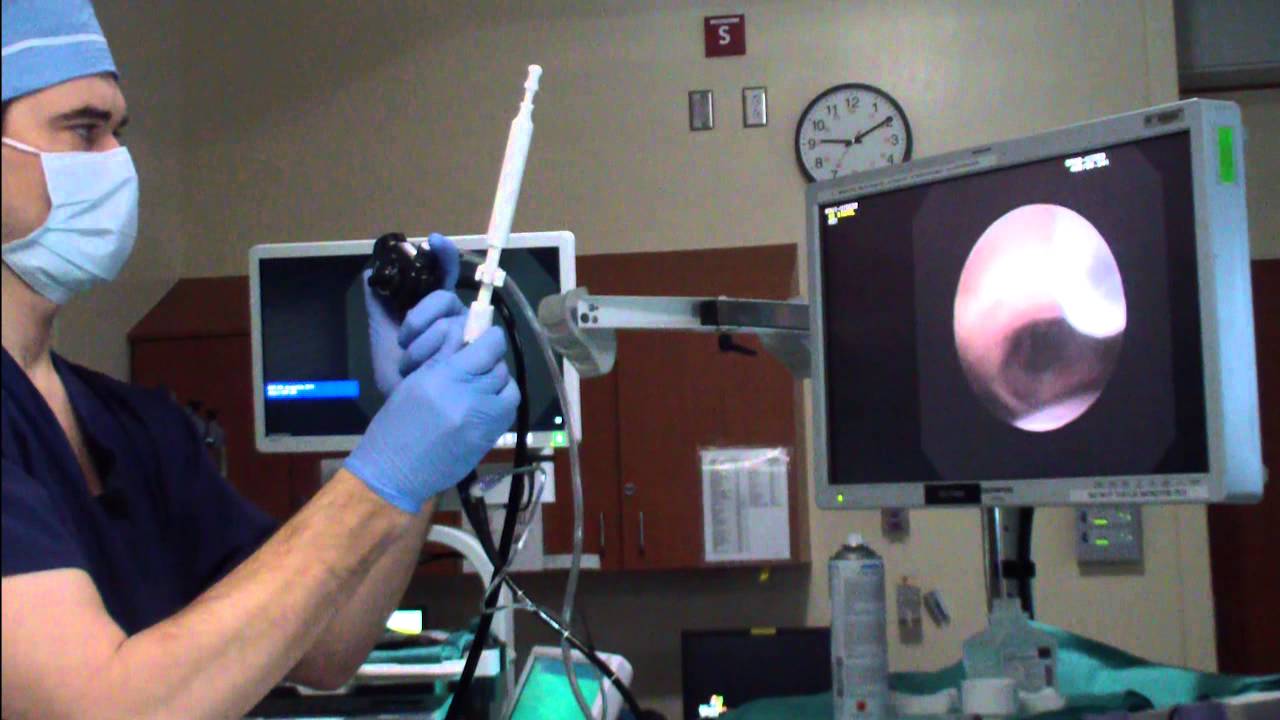 Endobronchial Ultrasound (EBUS) Technique & Tips