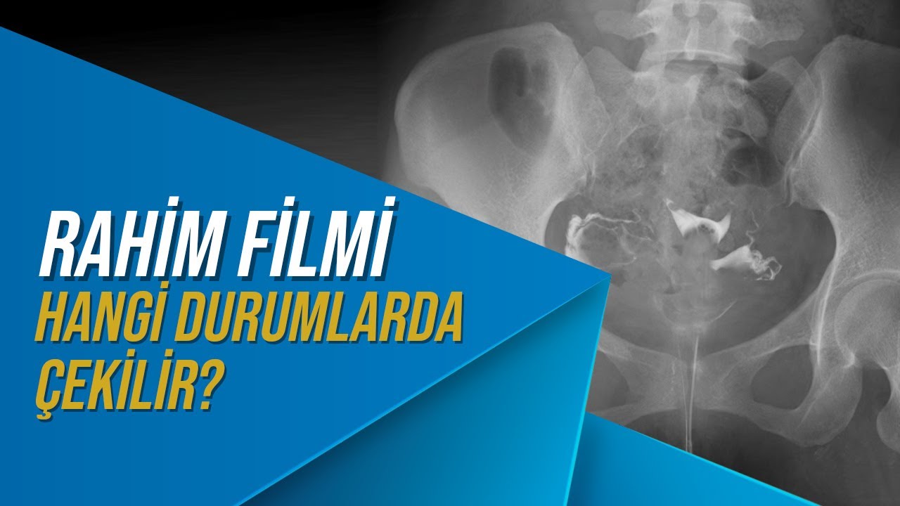 Rahim Filmi Nedir? Hangi Durumlarda Çekilir? Bebeğe Zarar Verir mi?