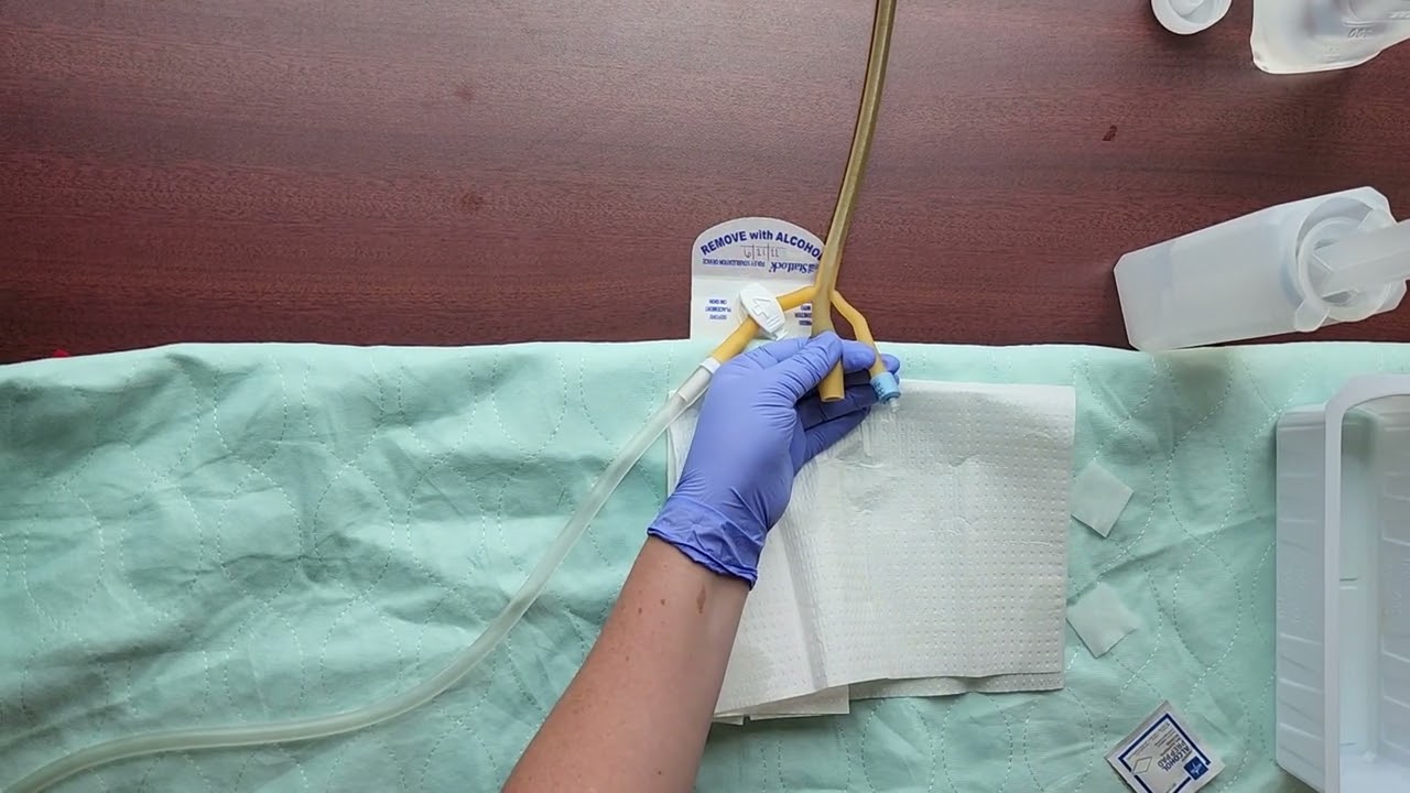 Manual Irrigation of CBI