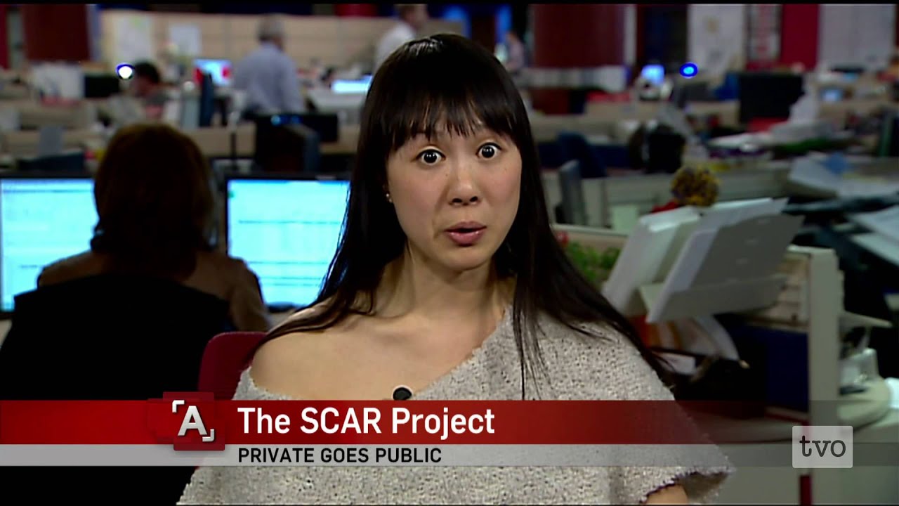 The SCAR Project