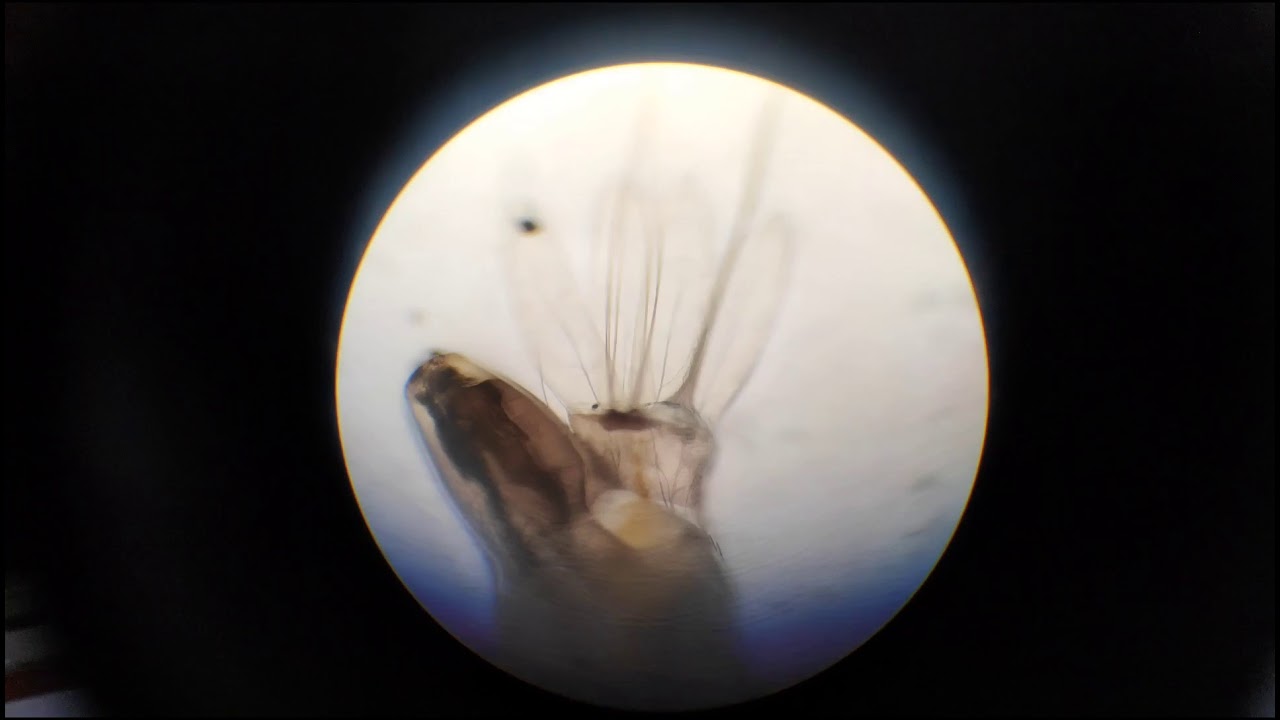 Mosquito Larvae - Aedes Aegypti under microscope