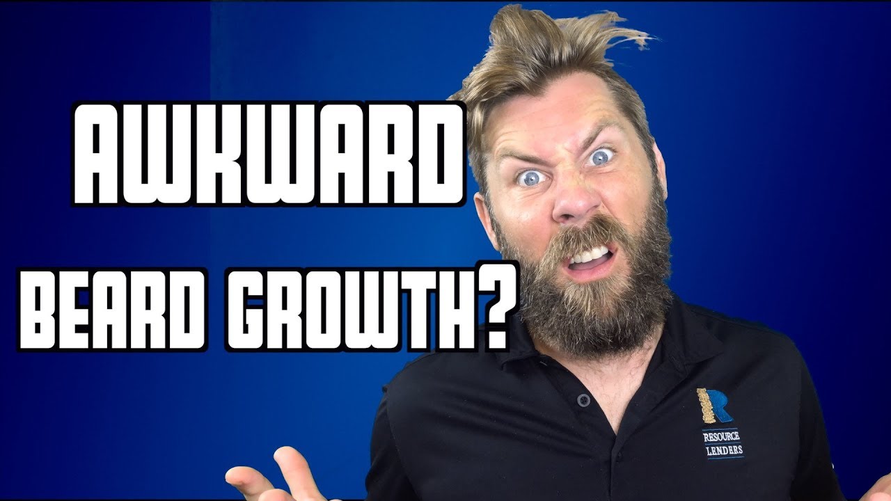 The Awkward Stage of Beard Growth | How to Push Through This Phase!!!