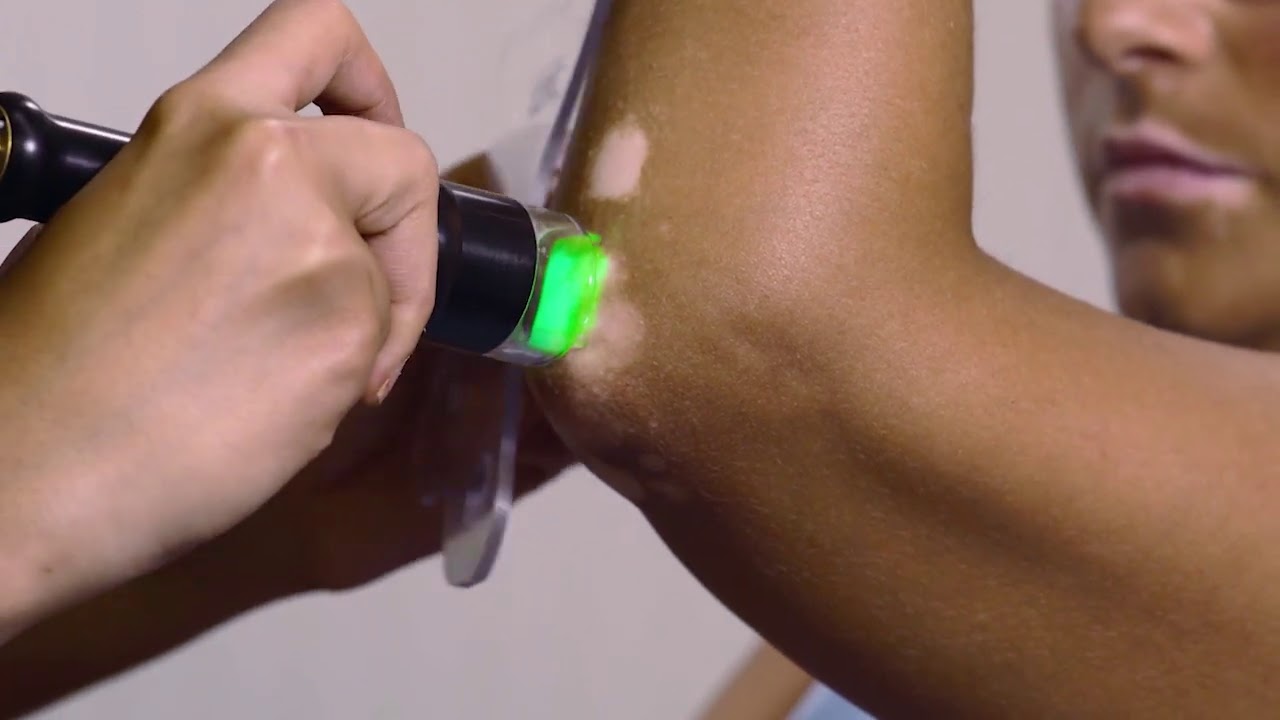 XTRAC&reg; Laser Therapy | Treatment Demonstration