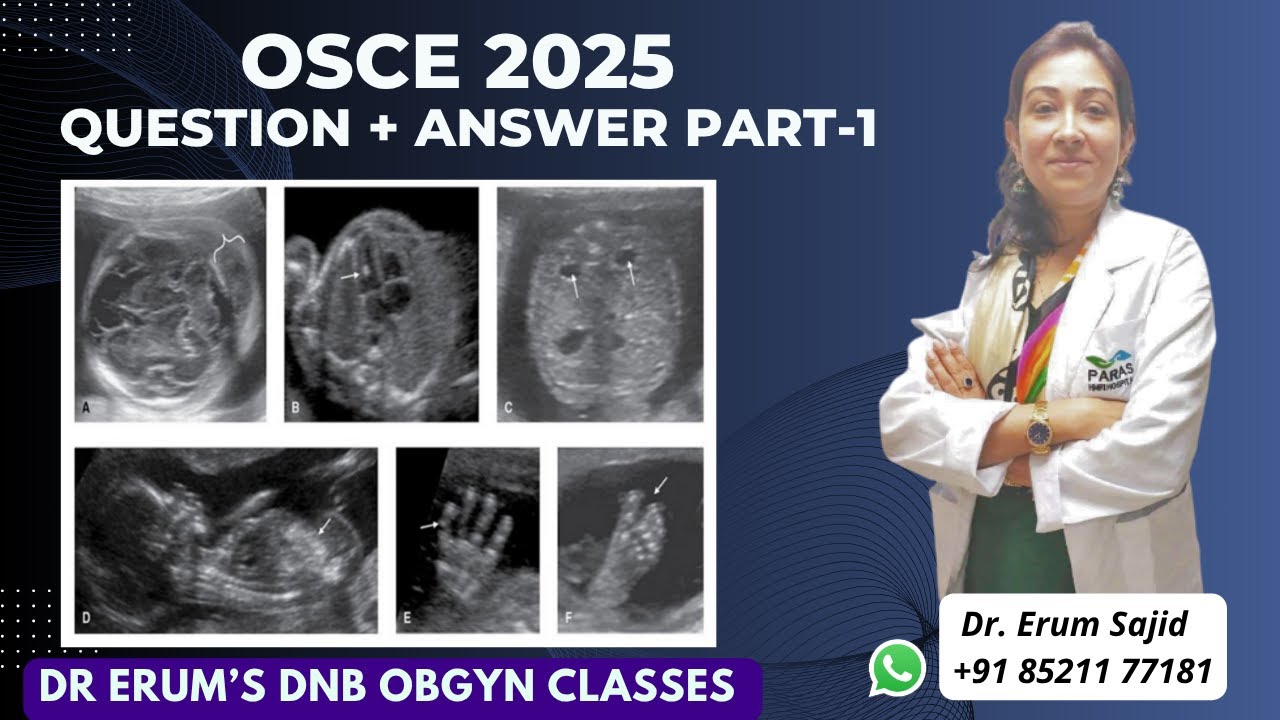 OSCE 2025 Q & A Part-1 | DNB Theory Class | DNB OBGYN coaching All India chapter | OBGYN Live Class