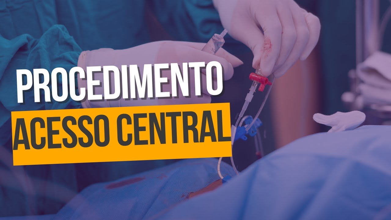 ACESSO VENOSO CENTRAL