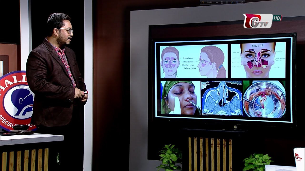 সাইনুসাইটিস এর কারন, লক্ষন এবং চিকিৎসা সম্পর্কে বিস্তারিত | Let's Talk with Dr. Bashudeb