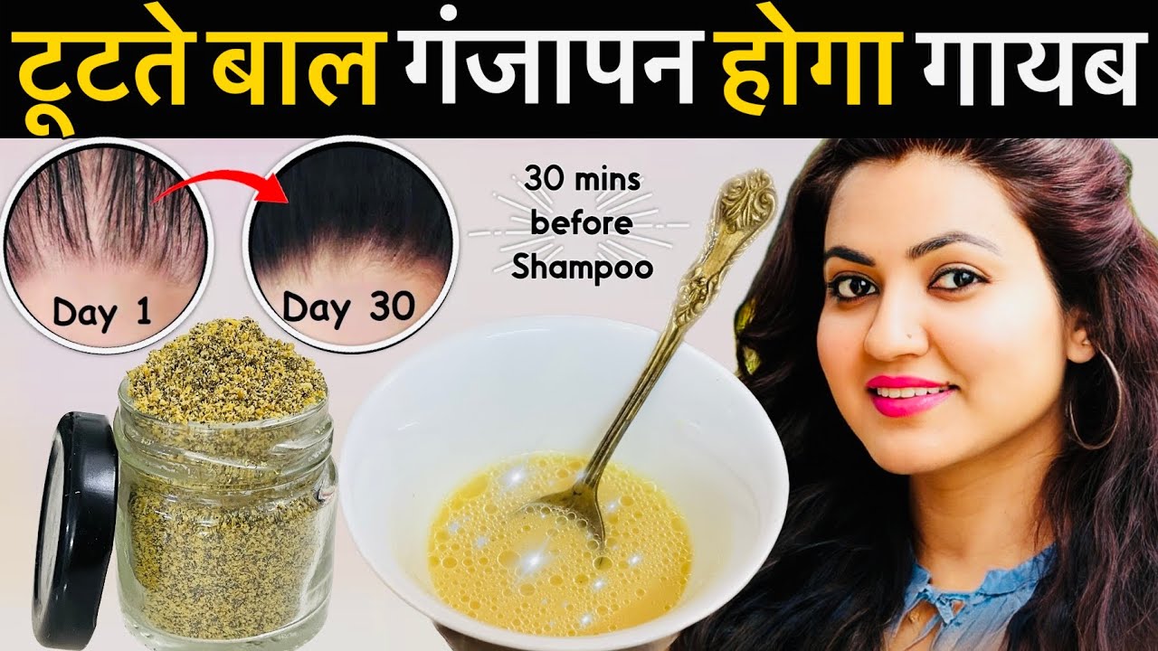30 Days Extreme Hair Growth Challenge : Regrow Lost hair, Fix Bald Patches & Hairline in 30 Days💕