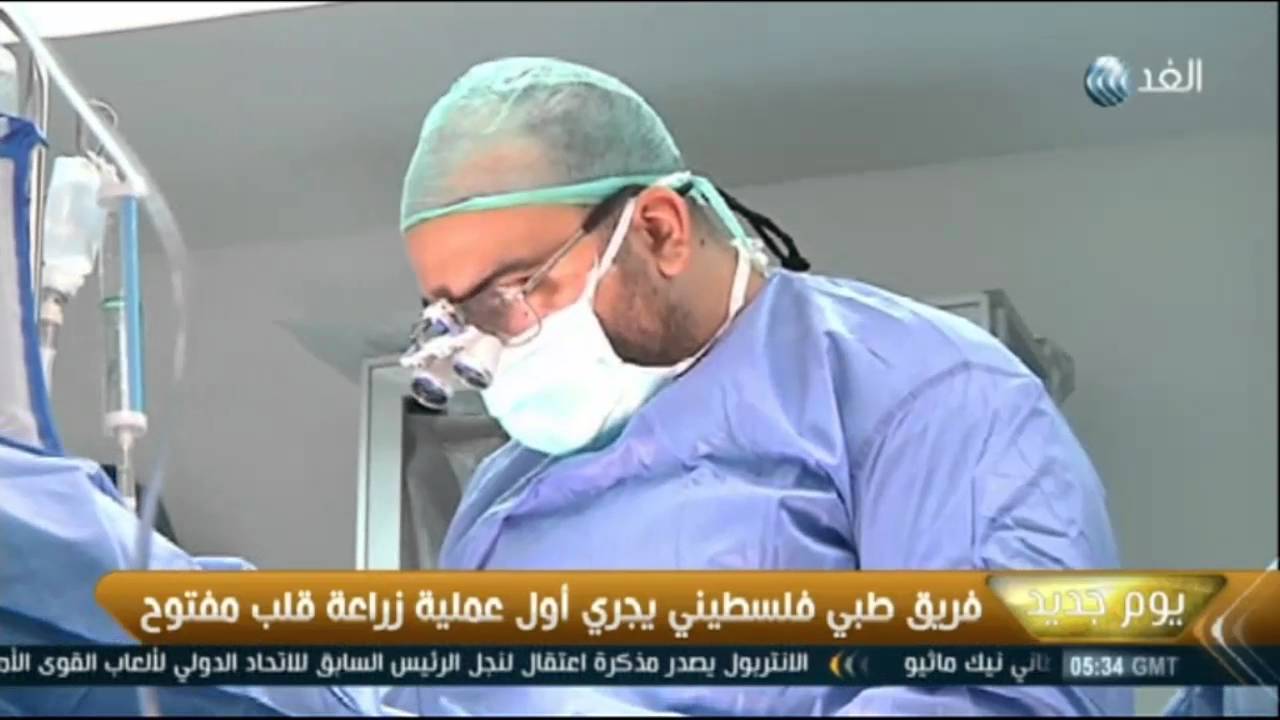 أول عملية زراعة قلب اصطناعي في فلسطين