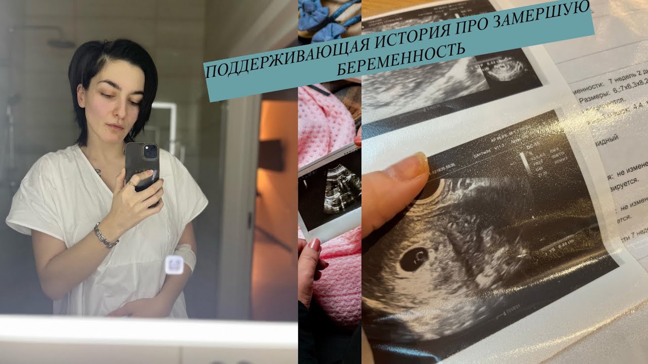 Замершая беременность. Что дальше? Как себе помочь? Позитивная история