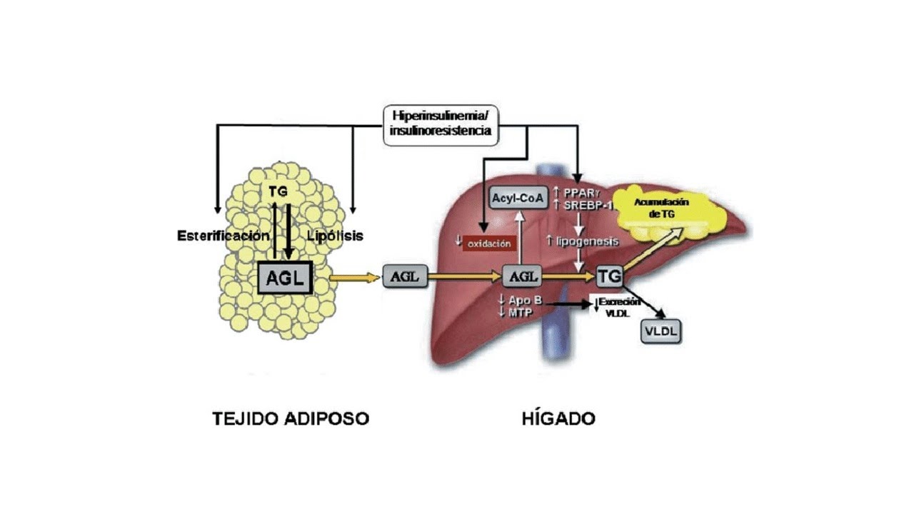 Diabetes, acidos grasos y trigliceridos