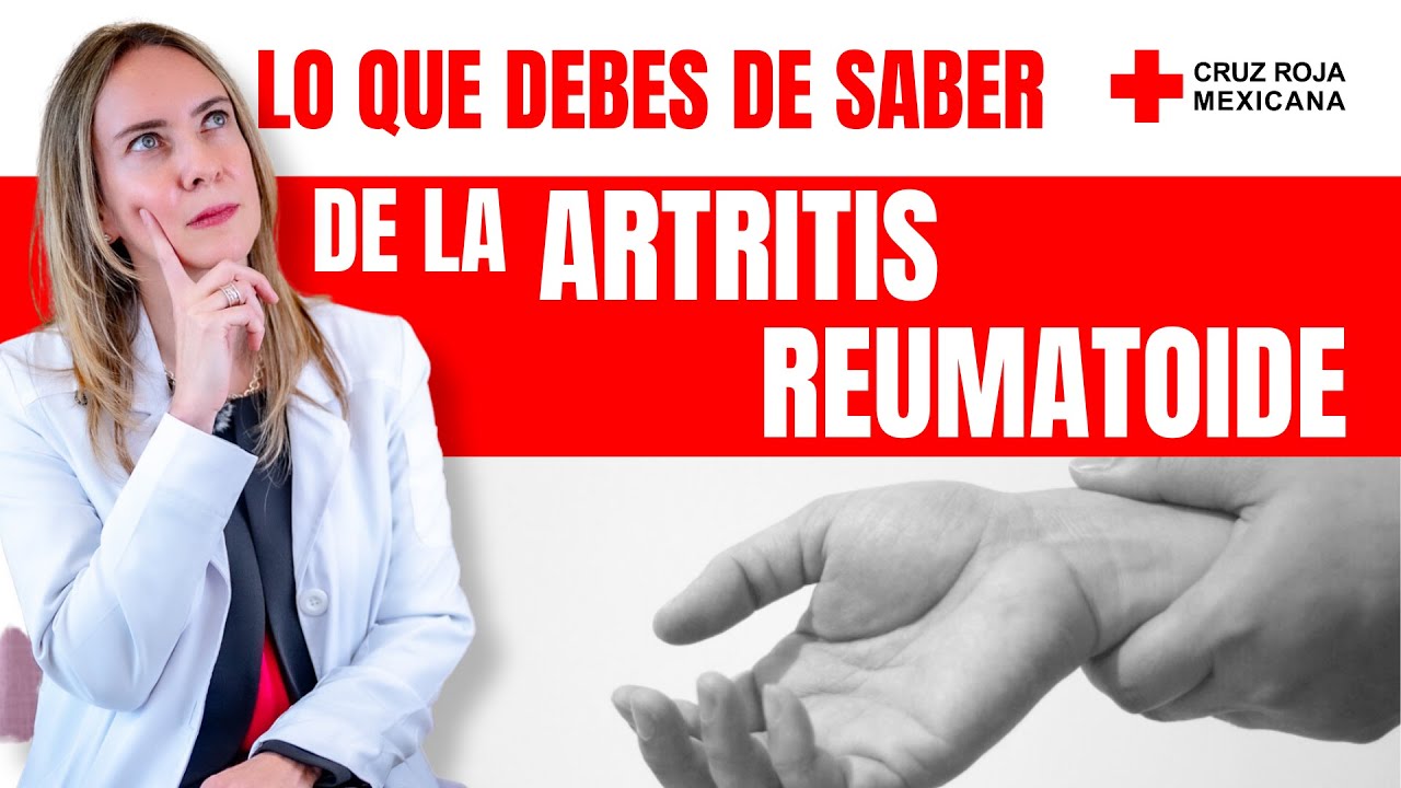 #Artritis Reumatoide: qué es, causas, síntomas y tratamiento
