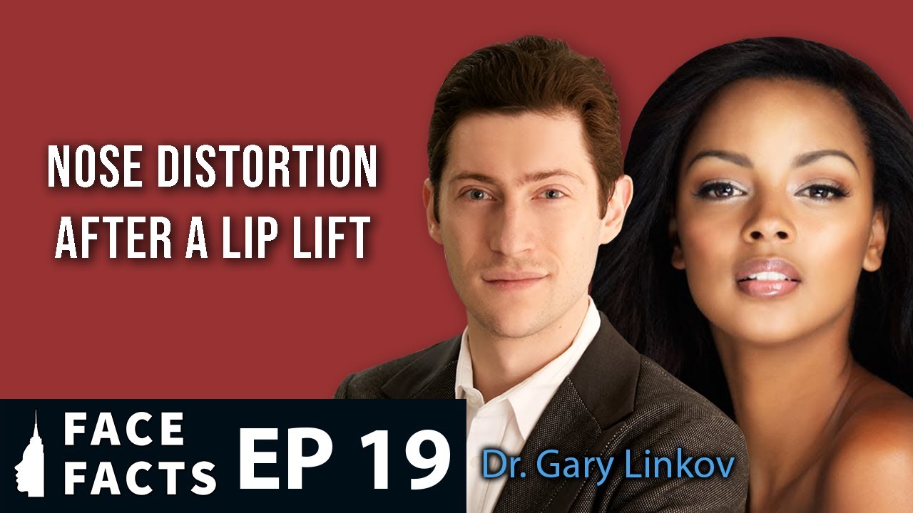 Nose Distortion after a Lip Lift - Dr. Gary Linkov