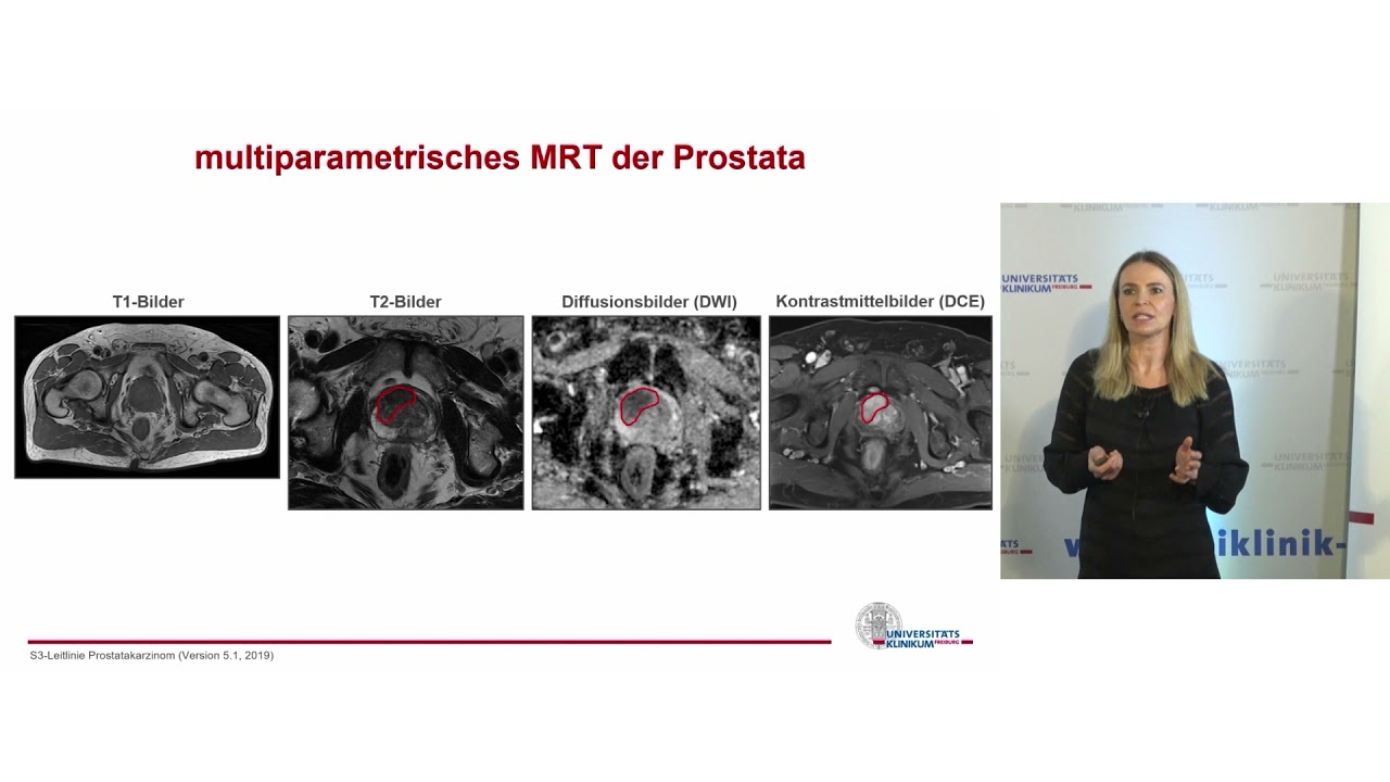 Diagnostik und Therapie beim Prostatakarzinom |  Prof. Dr. Cordula Jilg