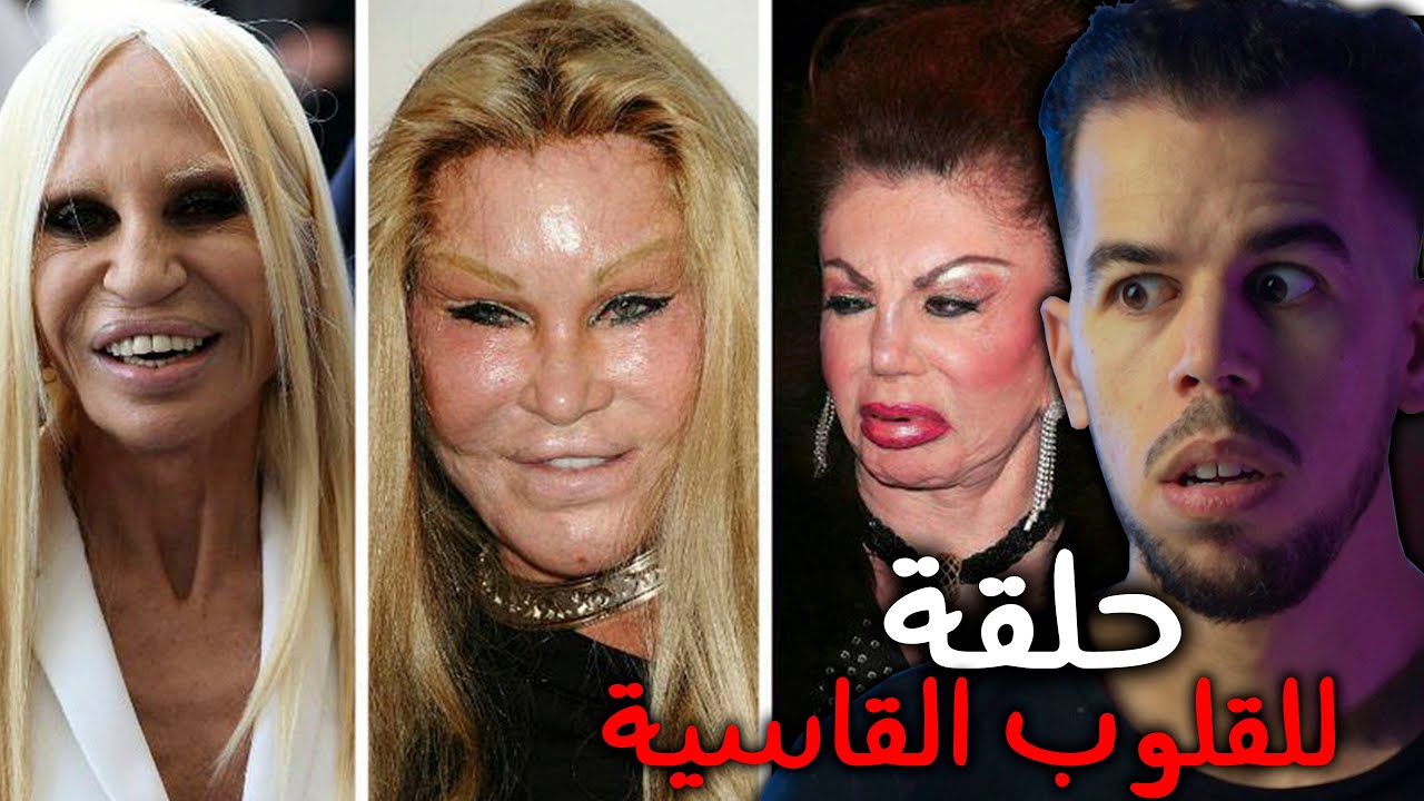 😰 أبشـ*ـع عمليات تجميل في العالم