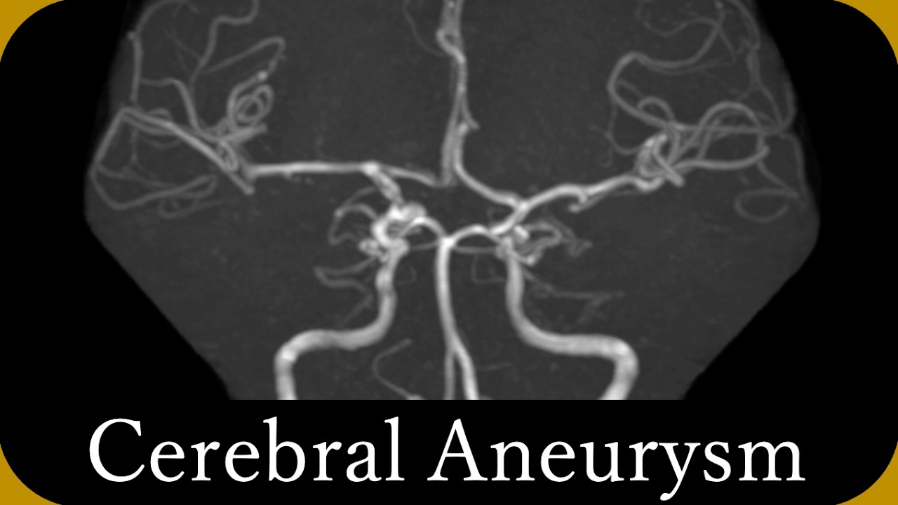 Imaging diagnosis of 