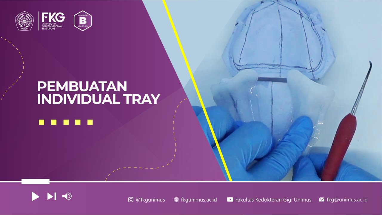 Pembuatan Individual Tray