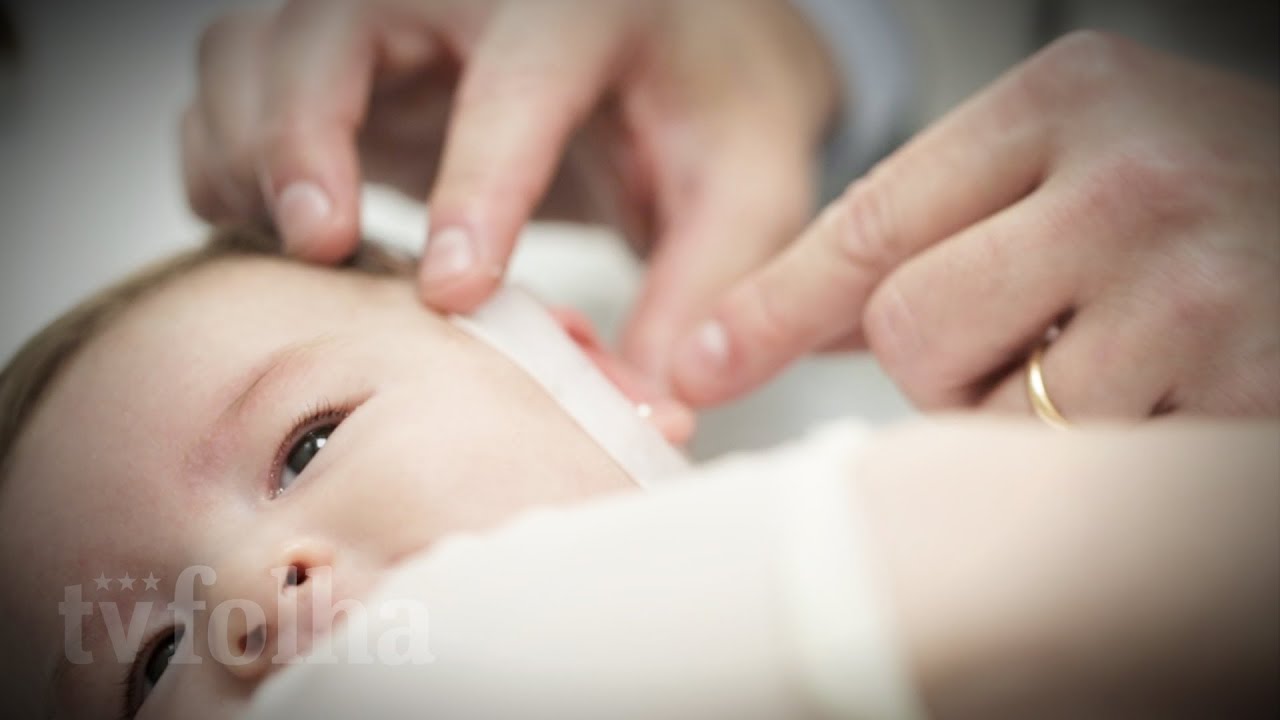 Molde de silicone corrige orelha de abano em bebês e dispensa cirurgia