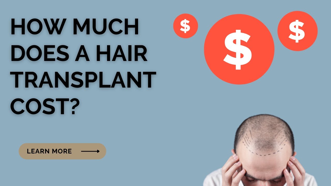 How Much Does a Hair Transplant Cost in Toronto? 2025 Prices & Factors
