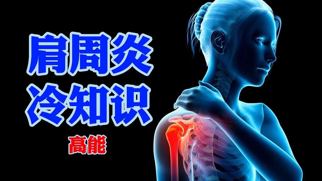 【读评论#3】你不得不知的有关肩周炎的冷知识，学会评估比盲目治疗更重要。