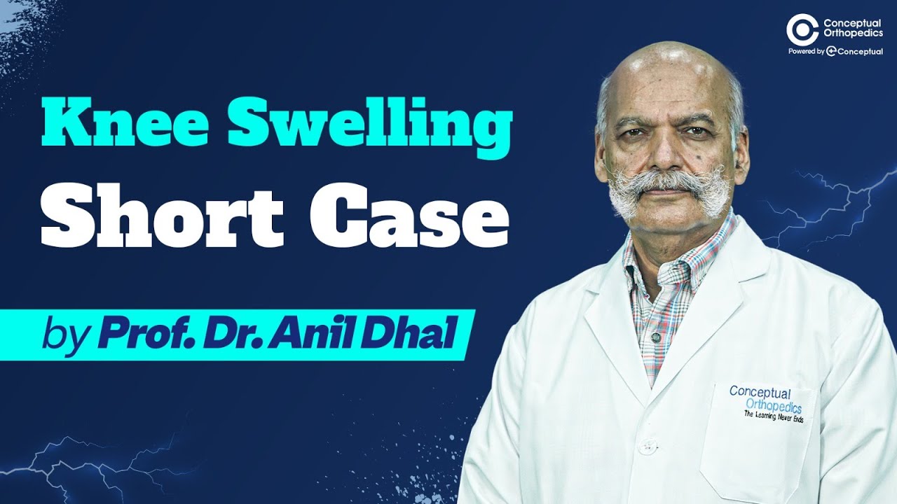 Knee Swelling Short Case by Prof Dr. Anil Dhal