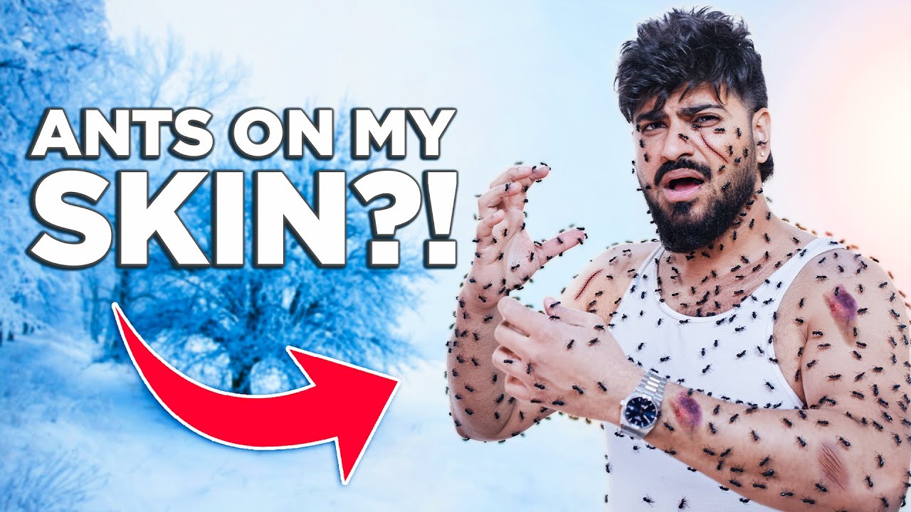 How to Get Rid of Itchy Skin Naturally | Causes & Home Treatments | Sahil Gera