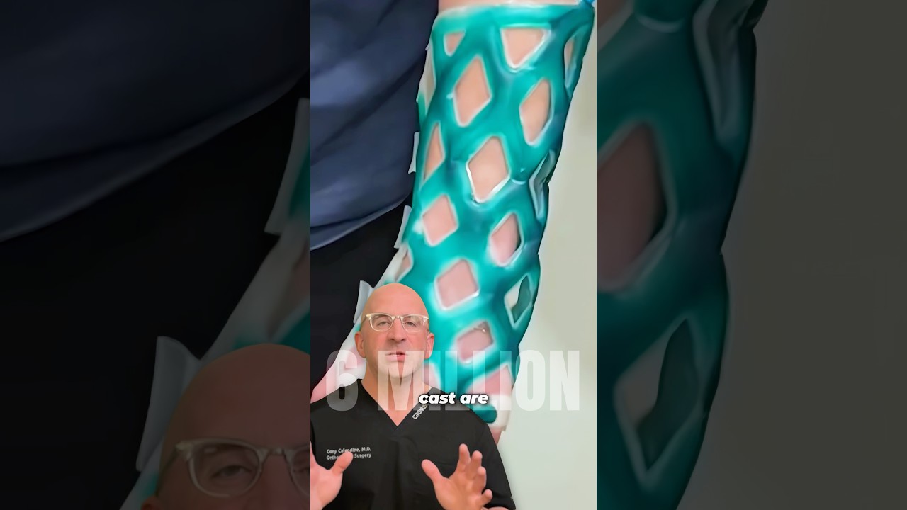 New Waterproof Cast Option For Broken Bones 🌊