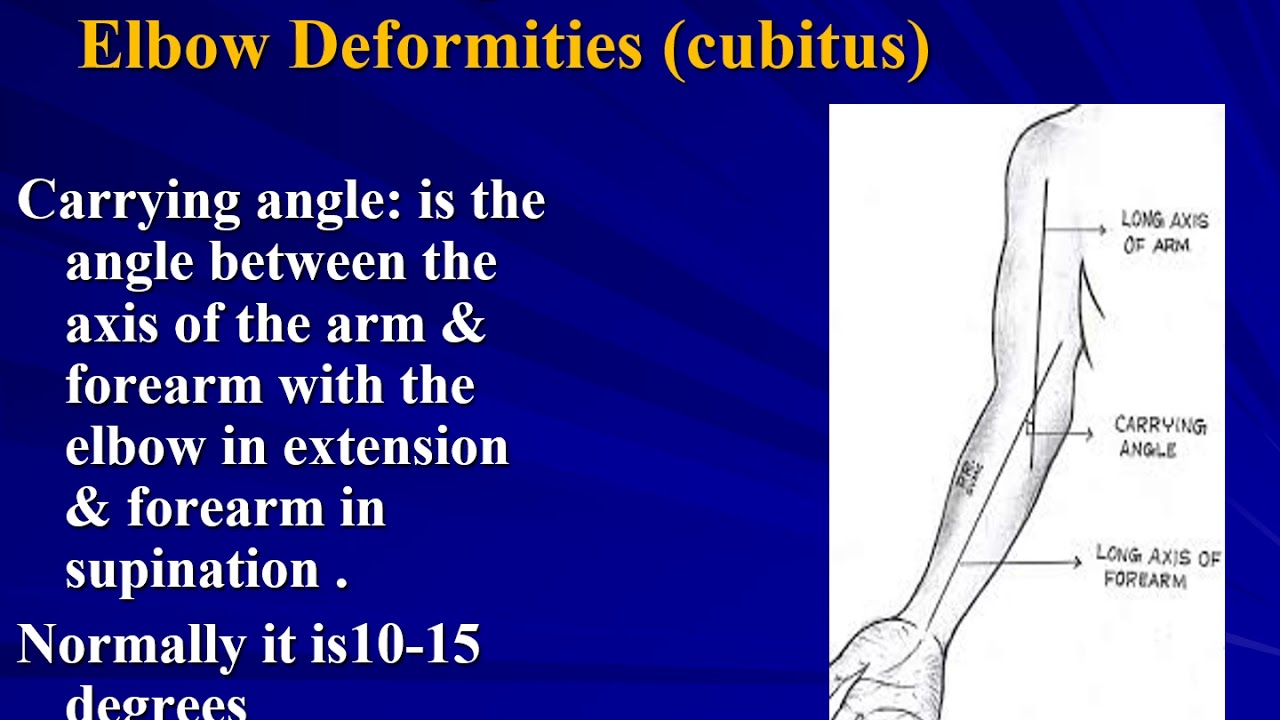 9-Deformities Prof.Dr.Lotfy Younis (For medical students)
