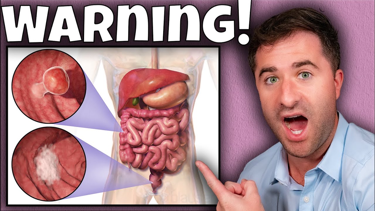 5 Signs of Colon Cancer You Should NEVER Ignore!