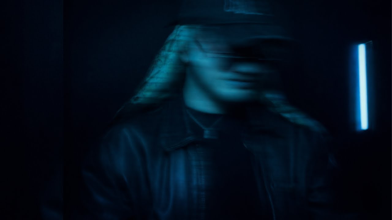 JIMMY NSC - XRAY