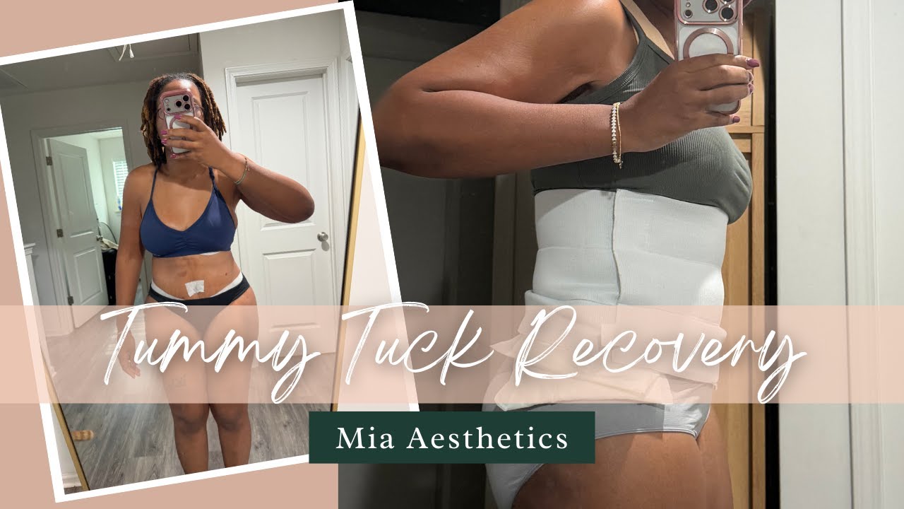 Tummy Tuck Recovery Day 11 | Mia Aesthetics Charlotte