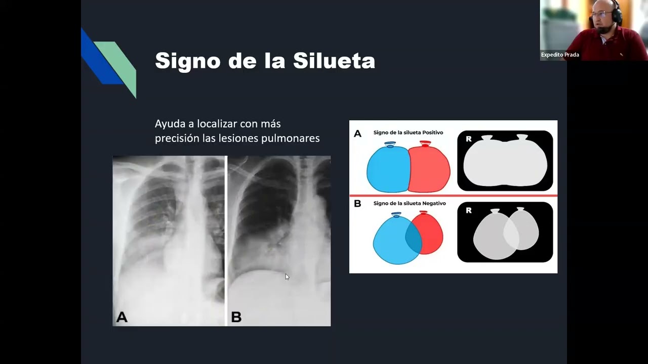 7   Infecciones pulmonares