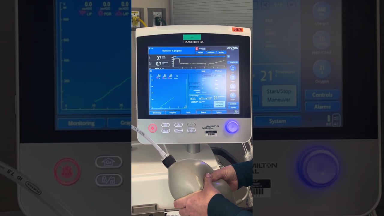 P/V tool on Hamilton G5 Step 2: Performing the Recruitment Maneuver