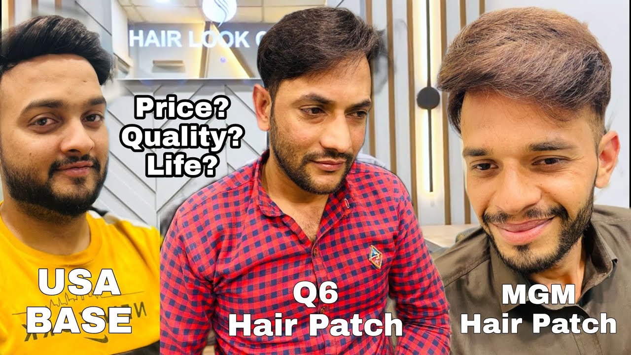 Difference Between USA BASE Hair Patch, Q6 Hair Patch and MGM Hair Patch | Informational Video