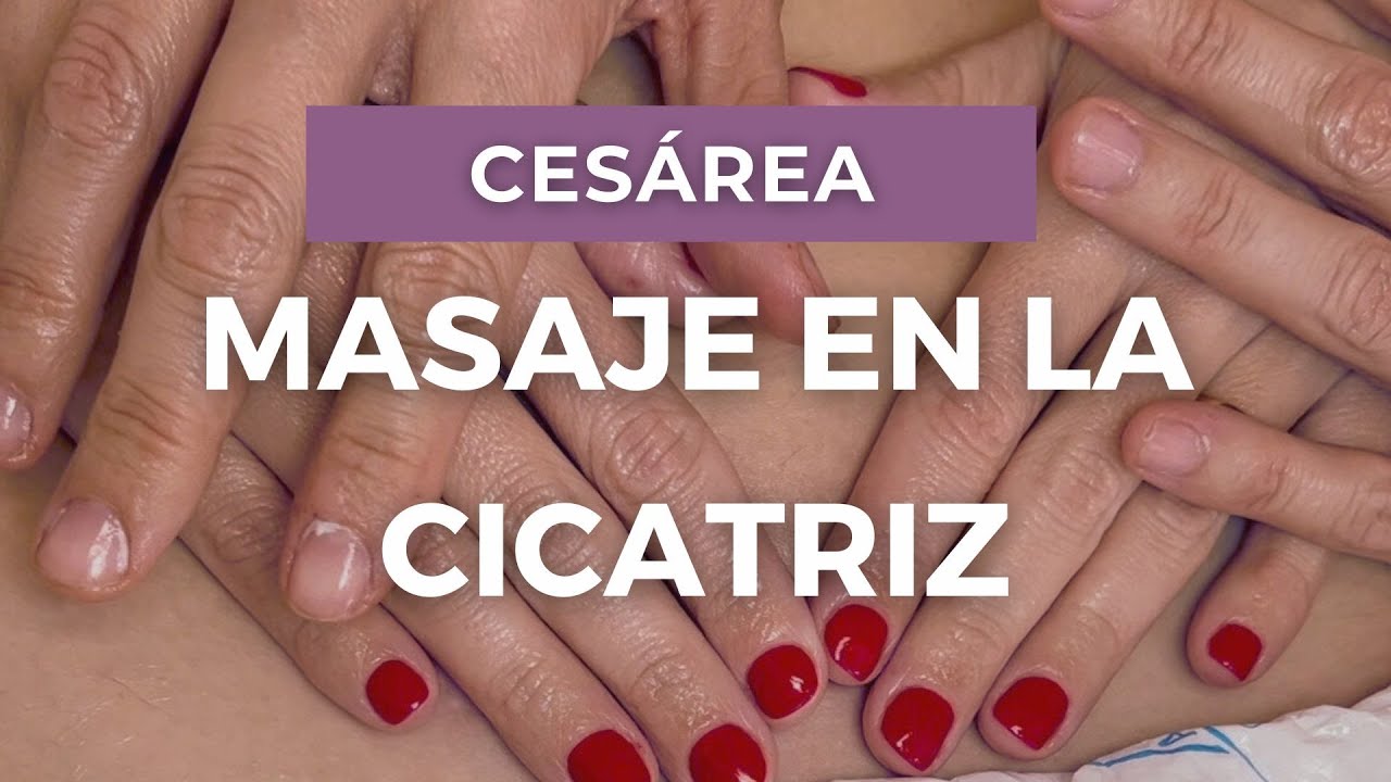 ✨❤️‍🩹Masaje Cicatriz #Cesárea Paso a Paso | Fisioterapia y Tratamiento.
