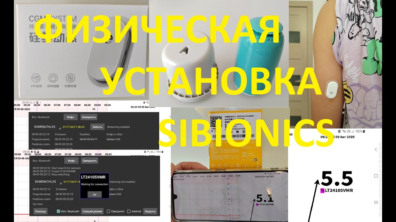 Физическая установка сенсора Sibionics и активация в программе Juggluco на Android-телефоне