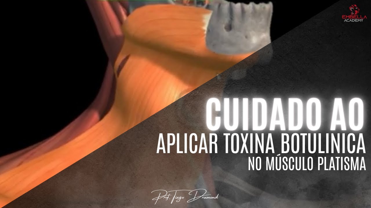 Cuidado ao aplicar toxina botulínica no músculo Platisma