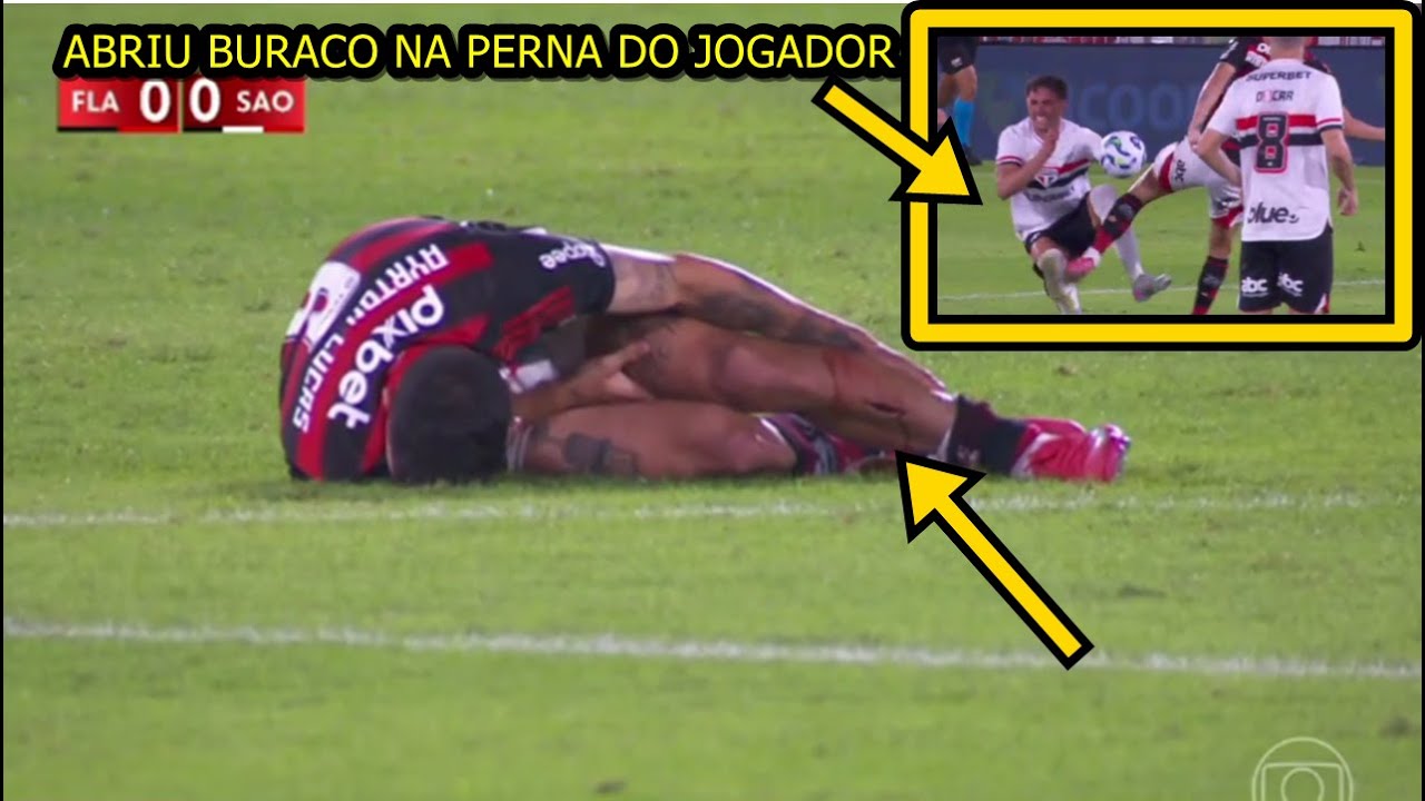 Ayrton Lucas sofre corte profundo na canela e sai chorando ap&oacute;s dividida com jogador do S&atilde;o Paulo