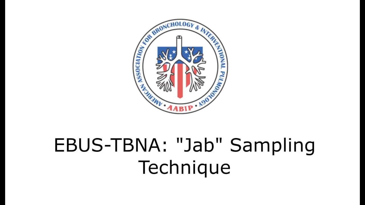EBUS-TBNA 