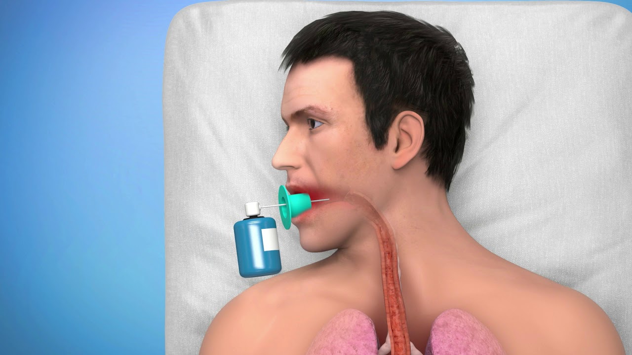 DANIS STENT - ELLA Extractor   Animation