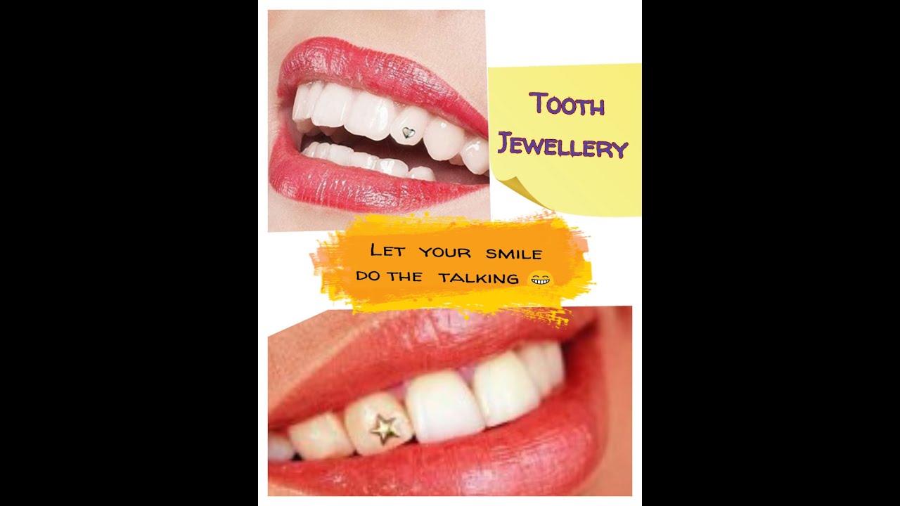 Get that bright shining smile with Tooth Jewellery  - Dr. Nidha Madan