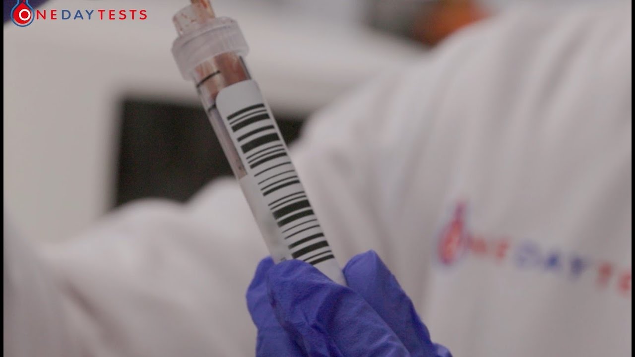 What You Need To Know About Full Blood Count Tests