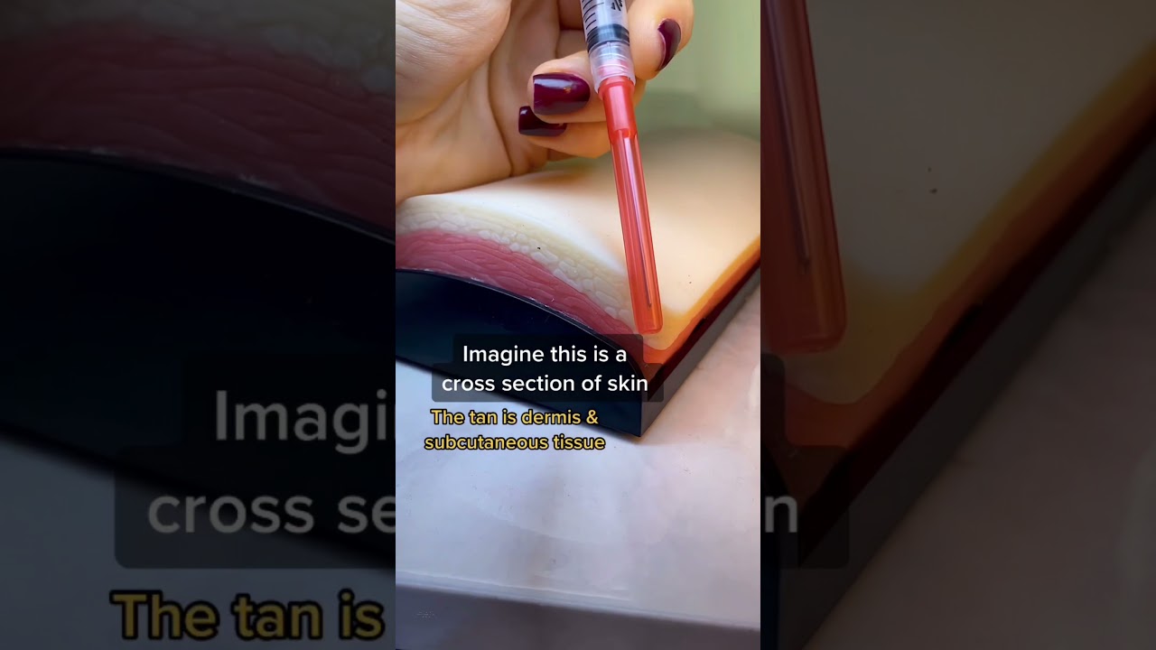 Do you know these types of injections?