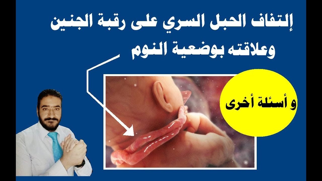 إلتفاف الحبل السري على رقبة الجنين وعلاقته بوضعية النوم وأسئلة أخرى _اختفاء أعراض الحمل#نبض الجنين