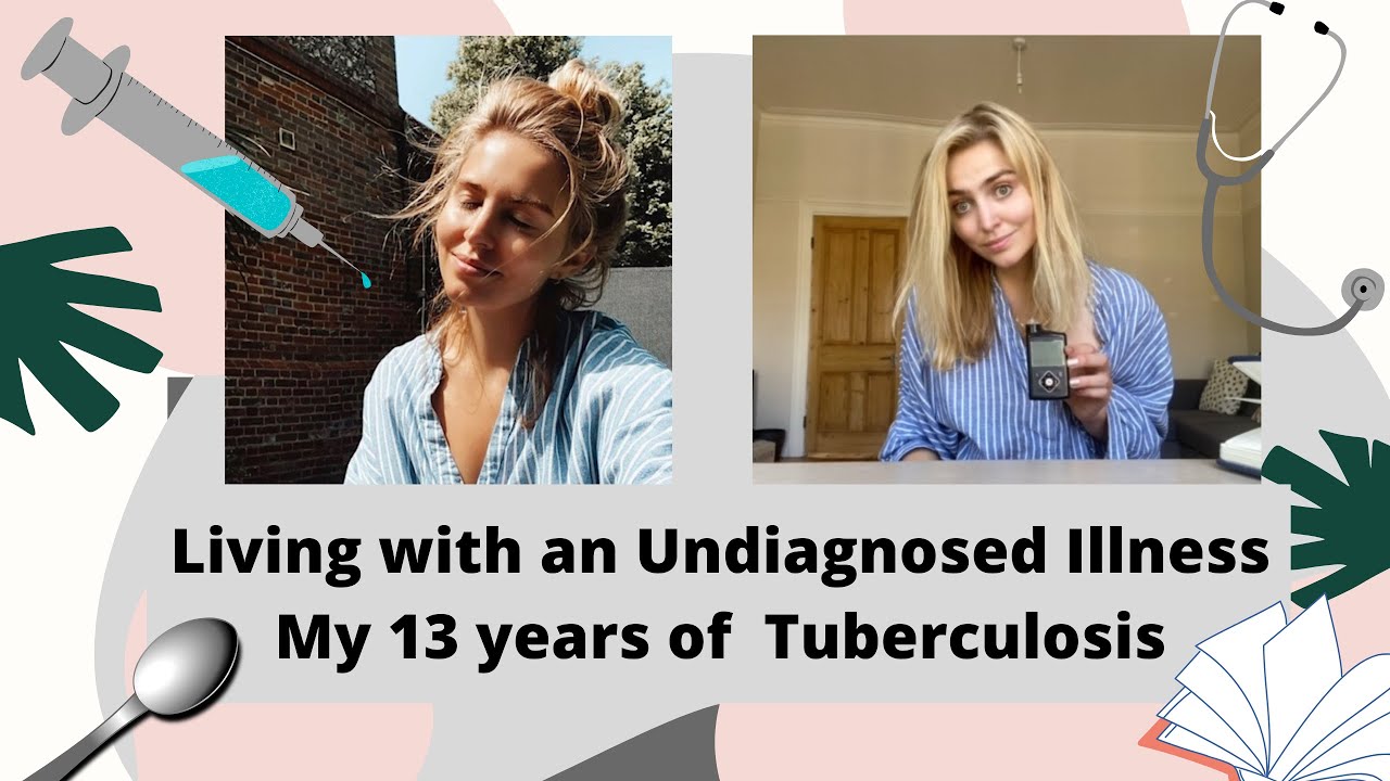 Living with an Undiagnosed Illness │My 13 years of Undiagnosed Tuberculosis