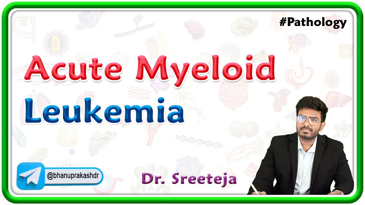 16. Острый миелоидный лейкоз | USMLE, шаг 1, патология