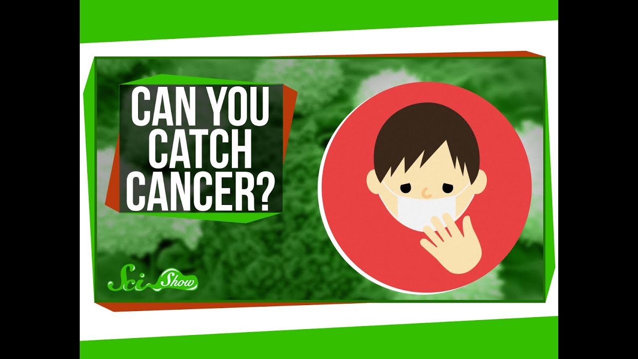 Can You Catch Cancer?