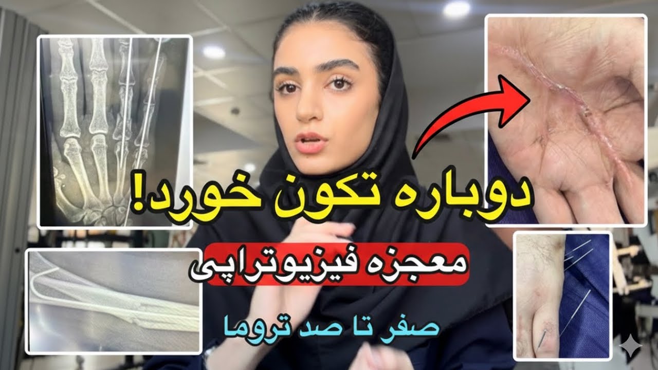 از تصادف شدید با موتور تا حرکت دوباره انگشتان!(بررسی کیس واقعی)