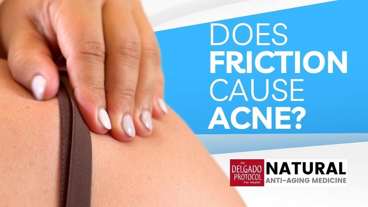 Does Friction Cause Acne? ǀ Dr. Nick Delgado PhD