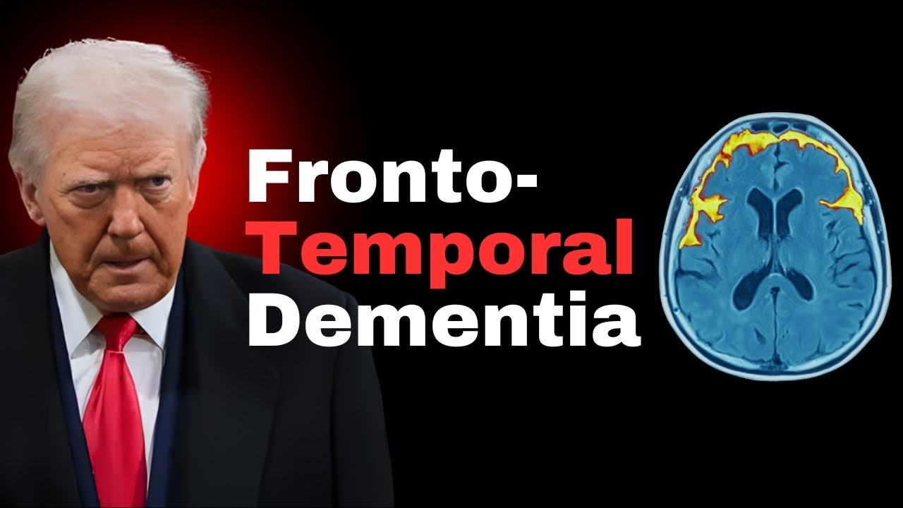 Neuroscientist Diagnoses Trump's Brain Damage