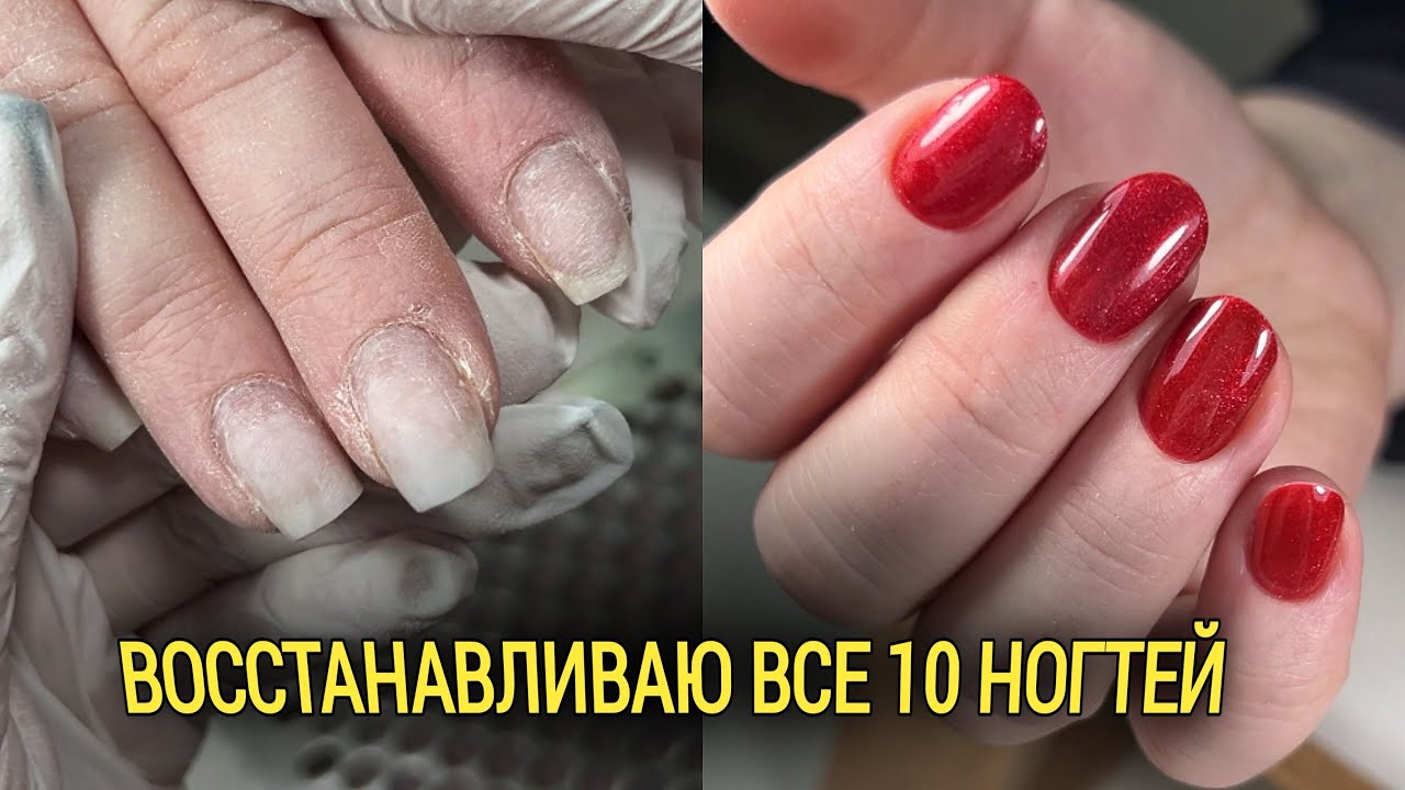Скрученные и клюющие ногти - как восстановить быстро? 😒 Лучшие материалы и инструменты для работы👌